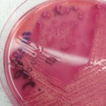 Identificazione colonie lattosio positive (terreno McConkey)